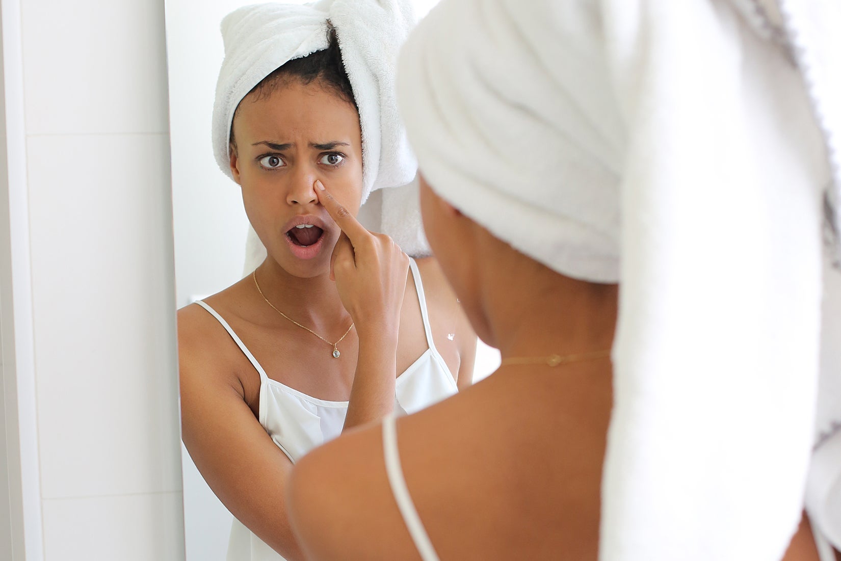 acne causes